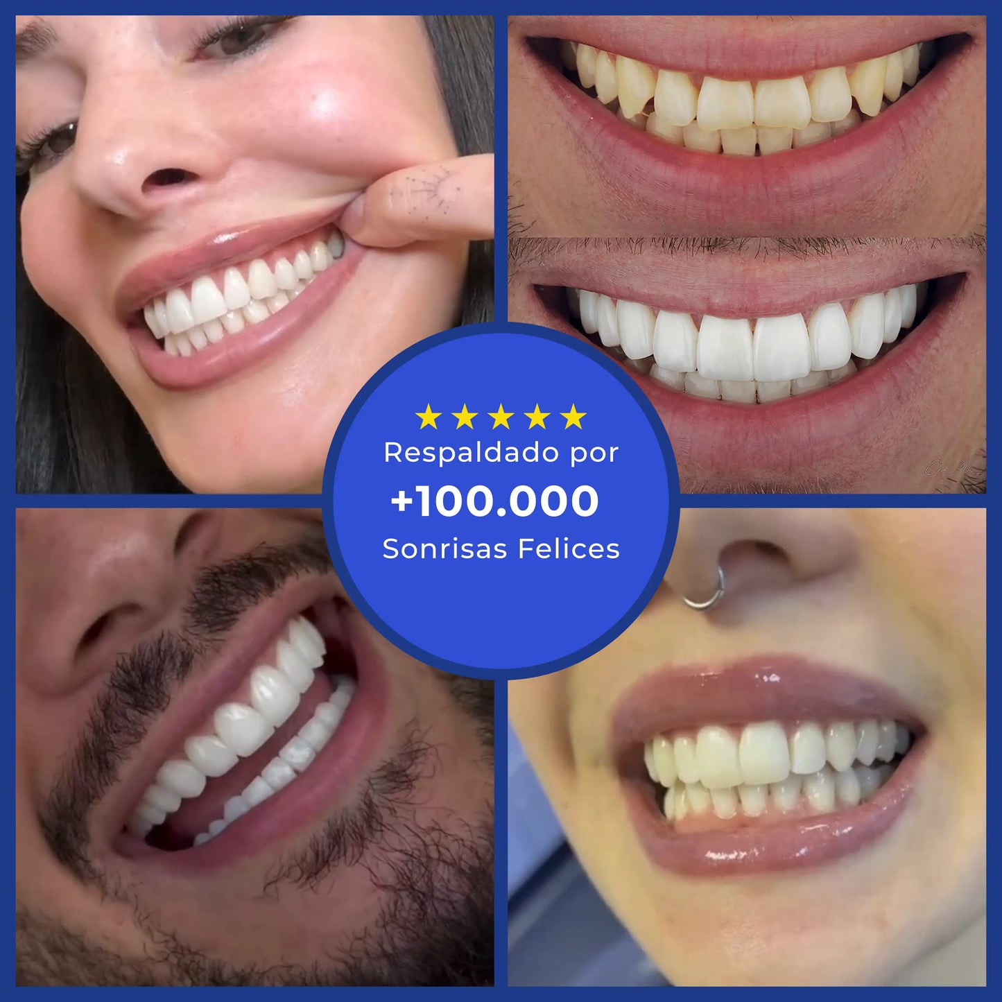 PureFlos™ Limpieza Bucal Profesional