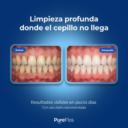 Sin mal aliento. En 60 segundos.