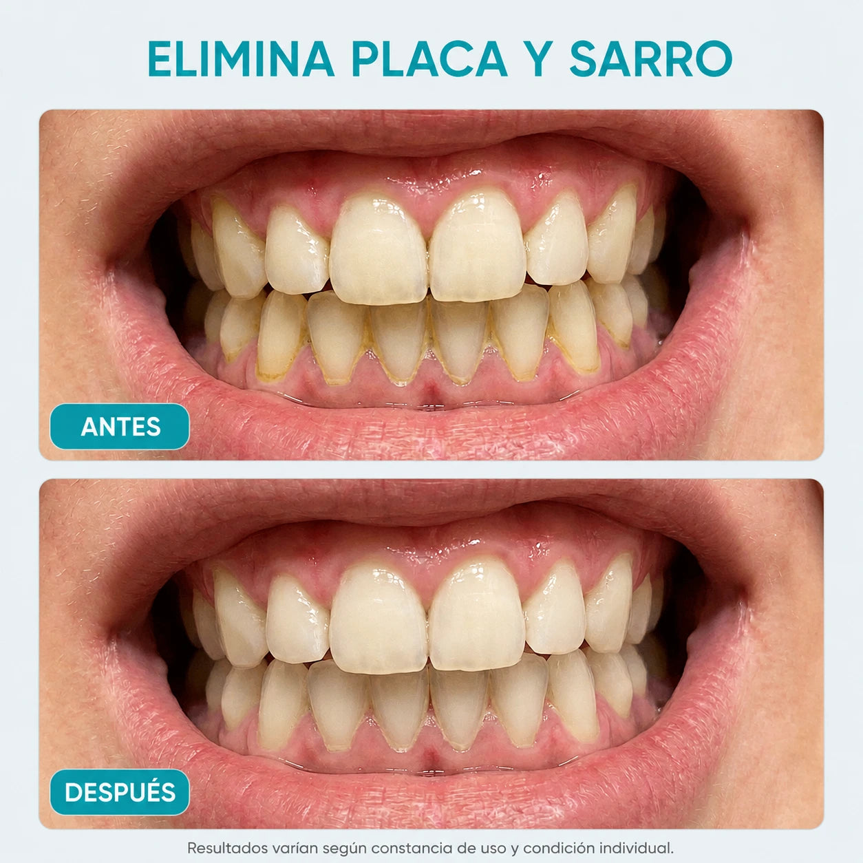 Irrigador Bucal PureFlos