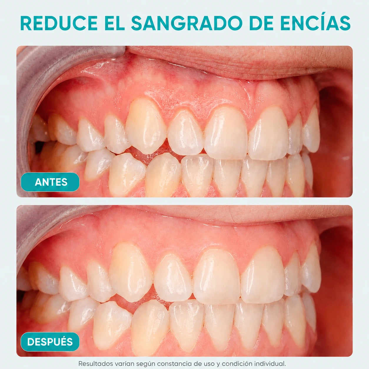 Irrigador Bucal PureFlos
