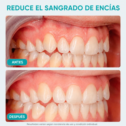 Irrigador Bucal PureFlos
